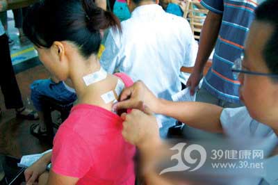 夏季天灸 強(qiáng)身防病不要等