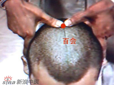 艾灸常用的保健穴有哪些？--百會(huì)